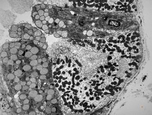 normal mucosa - stomach - parietal cell